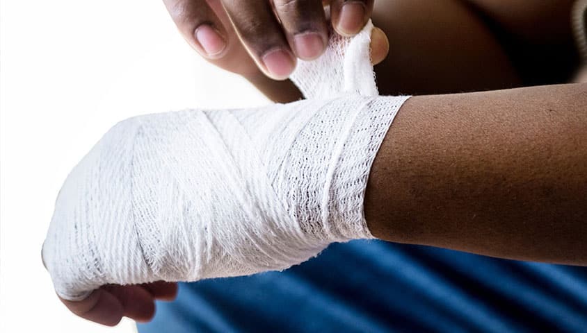 common-burn-injuries-in-personal-injury-claims-the-embry-law-firm